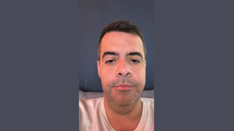 Entender a fundo o que o laudo comunica no BI-RADS 0 é essencial, e Vinicius Tadeu Sattin Rodrigues esclarece como lidar com essa classificação e conduzir a investigação complementar com segurança.